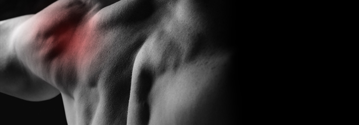 Image of a man with shoulder pain.